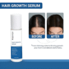 10 ML Hair Serum ( Hair Growth )