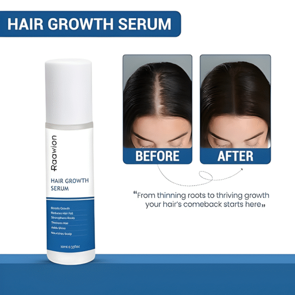10 ML Hair Serum ( Hair Growth )